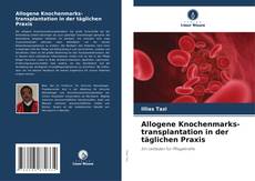 Allogene Knochenmarks-transplantation in der täglichen Praxis kitap kapağı