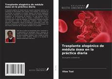 Bookcover of Trasplante alogénico de médula ósea en la práctica diaria