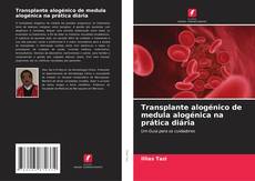 Couverture de Transplante alogénico de medula alogénica na prática diária