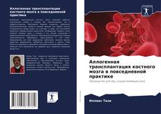 Bookcover of Аллогенная трансплантация костного мозга в повседневной практике