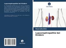 Lupusnephropathie bei Kindern的封面