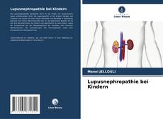 Lupusnephropathie bei Kindern kitap kapağı