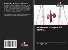 Buchcover von Nefropatia da lupus nei bambini