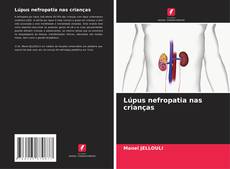 Couverture de Lúpus nefropatia nas crianças