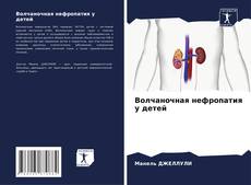 Bookcover of Волчаночная нефропатия у детей