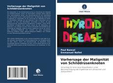 Buchcover von Vorhersage der Malignität von Schilddrüsenknoten