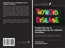 Bookcover of Predicción de la malignidad de los nódulos tiroideos