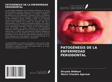 Borítókép a  PATOGÉNESIS DE LA ENFERMEDAD PERIODONTAL - hoz