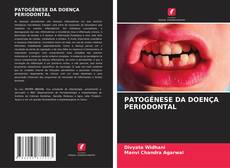 Buchcover von PATOGÉNESE DA DOENÇA PERIODONTAL