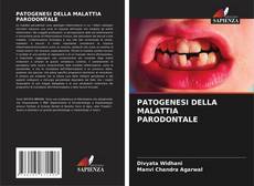 Copertina di PATOGENESI DELLA MALATTIA PARODONTALE