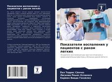 Buchcover von Показатели воспаления у пациентов с раком легких