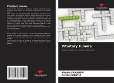 Bookcover of Pituitary tumors