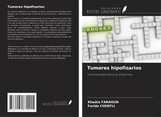 Tumores hipofisarios的封面