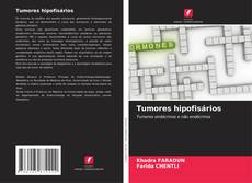 Couverture de Tumores hipofisários