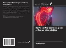 Bookcover of Rectocolitis hemorrágica: enfoque diagnóstico