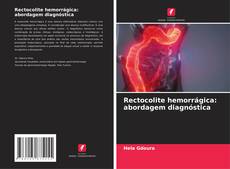 Bookcover of Rectocolite hemorrágica: abordagem diagnóstica