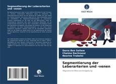 Bookcover of Segmentierung der Leberarterien und -venen