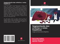 Capa do livro de Segmentação das artérias e veias hepáticas 