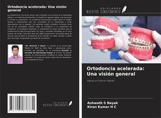 Ortodoncia acelerada: Una visión general的封面