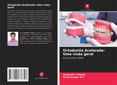 Buchcover von Ortodontia Acelerada: Uma visão geral