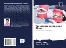 Bookcover of Ускоренная ортодонтия: Обзор