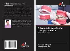 Buchcover von Ortodonzia accelerata: Una panoramica
