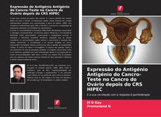 Expressão do Antigénio Antigénio do Cancro-Teste no Cancro do Ovário depois do CRS HIPEC的封面