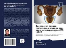 Bookcover of Экспрессия раково-тестисного антигена при раке яичников после CRS HIPEC
