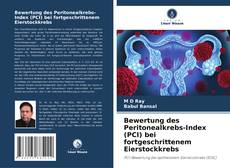 Bewertung des Peritonealkrebs-Index (PCI) bei fortgeschrittenem Eierstockkrebs kitap kapağı