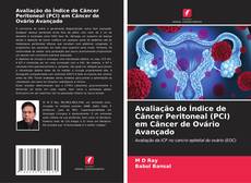 Avaliação do Índice de Câncer Peritoneal (PCI) em Câncer de Ovário Avançado的封面
