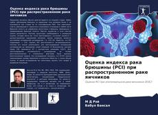 Portada del libro de Оценка индекса рака брюшины (PCI) при распространенном раке яичников