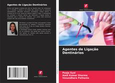 Buchcover von Agentes de Ligação Dentinários