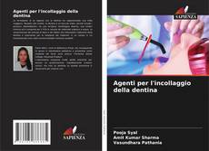 Couverture de Agenti per l'incollaggio della dentina