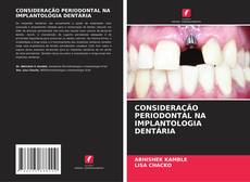 CONSIDERAÇÃO PERIODONTAL NA IMPLANTOLOGIA DENTÁRIA的封面