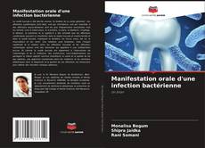 Bookcover of Manifestation orale d'une infection bactérienne