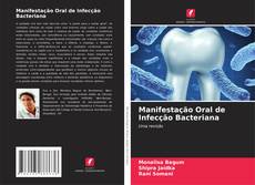 Manifestação Oral de Infecção Bacteriana的封面