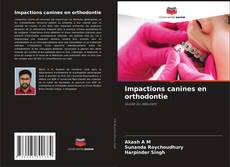 Bookcover of Impactions canines en orthodontie