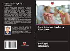 Buchcover von Prothèses sur implants - Réexamen