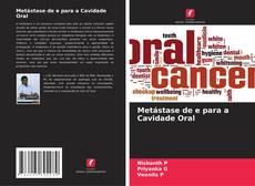 Couverture de Metástase de e para a Cavidade Oral