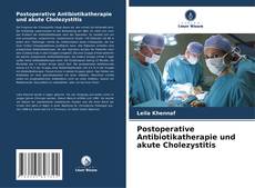 Postoperative Antibiotikatherapie und akute Cholezystitis的封面