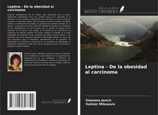 Copertina di Leptina - De la obesidad al carcinoma