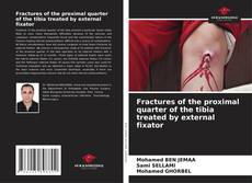 Buchcover von Fractures of the proximal quarter of the tibia treated by external fixator