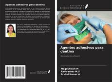 Capa do livro de Agentes adhesivos para dentina 