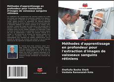 Buchcover von Méthodes d'apprentissage en profondeur pour l'extraction d'images de vaisseaux sanguins rétiniens