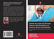 Bookcover of Gestão de Lesões de Manchas Brancas Não-Permitidas em Incisivos Jovens Permanentes
