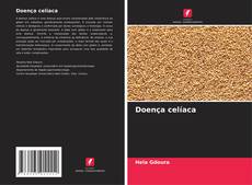 Bookcover of Doença celíaca