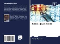 Bookcover of Краниофарингиома