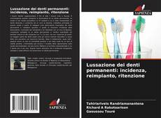 Copertina di Lussazione dei denti permanenti: incidenza, reimpianto, ritenzione