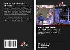 Copertina di Ponti miocardici dell'arteria coronaria