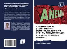 Автоматическое распознавание серповидноклеточной анемии, присутствующей в красных кровяных тельцах的封面